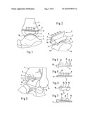 ANKLE-JOINT ENDOPROSTHESIS diagram and image