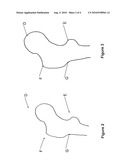 METHOD FOR DETERMINING AN ARRANGEMENT OF MEASUREMENT POINTS ON AN ANATOMICAL STRUCTURE diagram and image