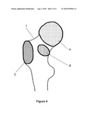 METHOD FOR DETERMINING AN ARRANGEMENT OF MEASUREMENT POINTS ON AN ANATOMICAL STRUCTURE diagram and image