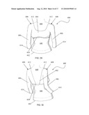 REVERSIBLE SLEEVED GARMENT ACCESSORY diagram and image