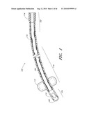 METHODS FOR CLEANING ENDOTRACHEAL TUBES diagram and image