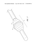 METHODS FOR CLEANING ENDOTRACHEAL TUBES diagram and image