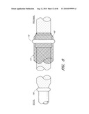 METHODS FOR CLEANING ENDOTRACHEAL TUBES diagram and image