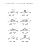 METHODS FOR CLEANING ENDOTRACHEAL TUBES diagram and image