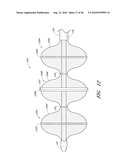 METHODS FOR CLEANING ENDOTRACHEAL TUBES diagram and image