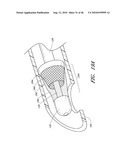 METHODS FOR CLEANING ENDOTRACHEAL TUBES diagram and image