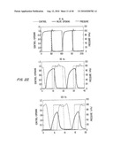 Microfabricated Elastomeric Valve And Pump Systems diagram and image