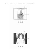 MEDICAL DIAGNOSTIC IMAGING APPARATUS AND IMAGE CORRECTION METHOD diagram and image