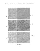 MULTISCALE EDGE DETECTION AND FIBER ENHANCEMENT USING DIFFERENCES OF ORIENTED MEANS diagram and image