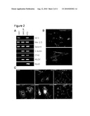 PROVISION OF NEW CARDIOMYOCYTE PROGENITOR CELLS AND CARDIOMYOCYTES DERIVED THEREFROM diagram and image