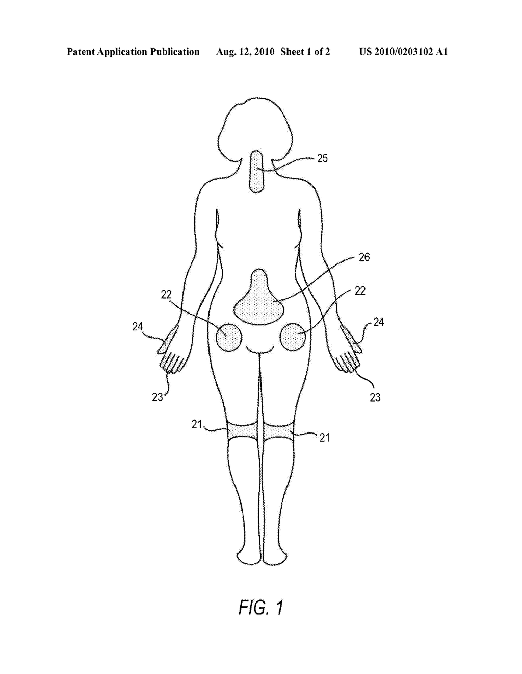 COMPOSITIONS AND METHODS FOR TREATING POST-OPERATIVE PAIN USING BUPIVACAINE AND AN ANTI-ONFLAMMATORY AGENT - diagram, schematic, and image 02