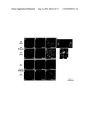 G-SUBSTRATE FOR THE TREATMENT AND PREVENTION OF PARKINSON S DISEASE diagram and image