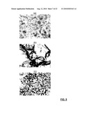 INJECTABLE POLYMER-LIPID BLEND FOR LOCALIZED DRUG DELIVERY diagram and image