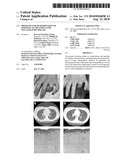 Profiling for Determination of Response to Treatment for Inflammatory Disease diagram and image