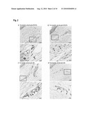 Profiling for Determination of Response to Treatment for Inflammatory Disease diagram and image