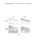 USE OF ANITMICROBIAL PROTEINS AND PEPTIDES FOR THE TREATMENT OF OTITIS MEDIA AND PARANASAL SINUSITIS diagram and image