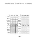 USE OF ANITMICROBIAL PROTEINS AND PEPTIDES FOR THE TREATMENT OF OTITIS MEDIA AND PARANASAL SINUSITIS diagram and image