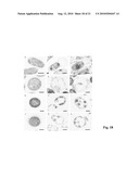 USE OF ANITMICROBIAL PROTEINS AND PEPTIDES FOR THE TREATMENT OF OTITIS MEDIA AND PARANASAL SINUSITIS diagram and image