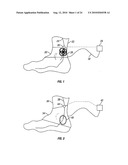 METHOD AND APPARATUS FOR MAGNETIC INDUCTION THERAPY diagram and image