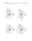 METHOD AND APPARATUS FOR MAGNETIC INDUCTION THERAPY diagram and image