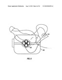 METHOD AND APPARATUS FOR MAGNETIC INDUCTION THERAPY diagram and image