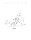 METHOD AND APPARATUS FOR MAGNETIC INDUCTION THERAPY diagram and image