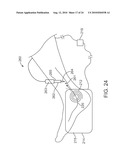 METHOD AND APPARATUS FOR MAGNETIC INDUCTION THERAPY diagram and image