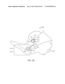 METHOD AND APPARATUS FOR MAGNETIC INDUCTION THERAPY diagram and image