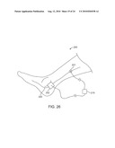 METHOD AND APPARATUS FOR MAGNETIC INDUCTION THERAPY diagram and image