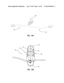 SYSTEM FOR PLACEMENT OF A CATHETER INCLUDING A SIGNAL-GENERATING STYLET diagram and image