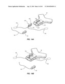 SYSTEM FOR PLACEMENT OF A CATHETER INCLUDING A SIGNAL-GENERATING STYLET diagram and image