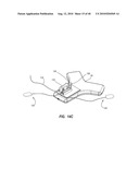 SYSTEM FOR PLACEMENT OF A CATHETER INCLUDING A SIGNAL-GENERATING STYLET diagram and image