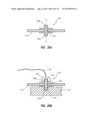 SYSTEM FOR PLACEMENT OF A CATHETER INCLUDING A SIGNAL-GENERATING STYLET diagram and image