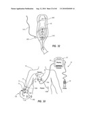 SYSTEM FOR PLACEMENT OF A CATHETER INCLUDING A SIGNAL-GENERATING STYLET diagram and image