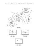 SYSTEM FOR PLACEMENT OF A CATHETER INCLUDING A SIGNAL-GENERATING STYLET diagram and image