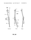 METHOD AND SYSTEM FOR ENHANCING ACCURACY IN ULTRASONIC ALIGNMENT diagram and image