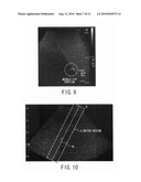 ULTRASONIC DIAGNOSTIC APPARATUS AND ULTRASONIC DIAGNOSTIC METHOD diagram and image