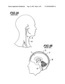 NON-INVASIVE INTRACRANIAL PRESSURE SENSOR diagram and image