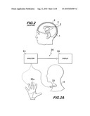 NON-INVASIVE INTRACRANIAL PRESSURE SENSOR diagram and image