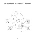 Apparatus And Method For Cardiac Ablation diagram and image