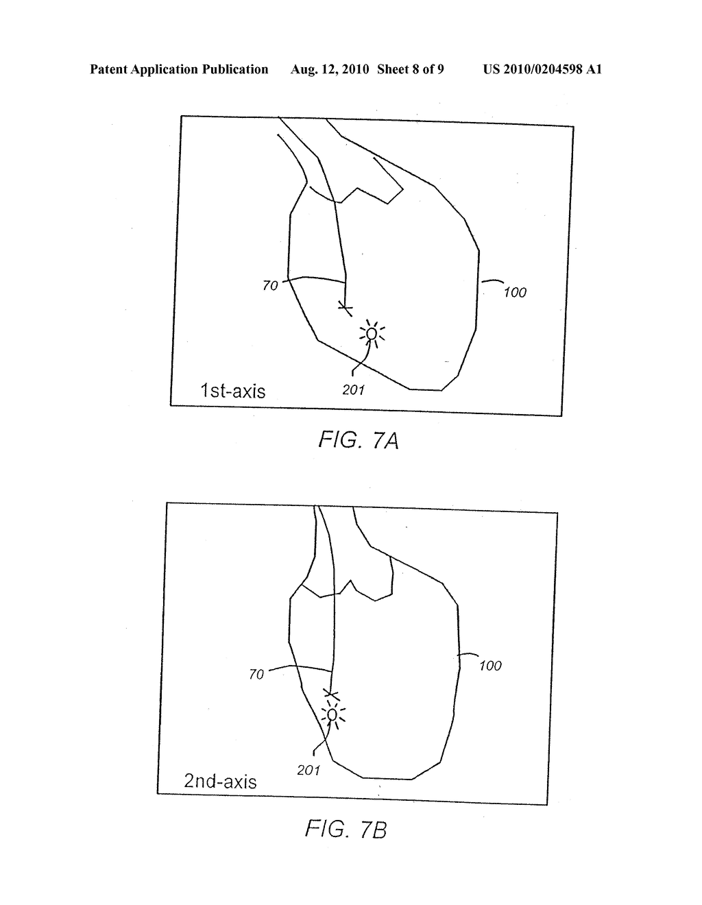 Apparatus And Method For Cardiac Ablation - diagram, schematic, and image 09