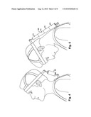 Apparatus and Methods for Reducing Brain and Cervical Spine Injury diagram and image