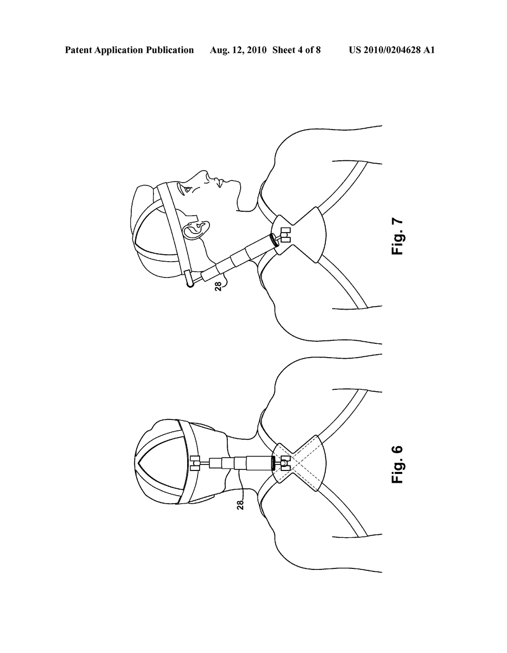 Apparatus and Methods for Reducing Brain and Cervical Spine Injury - diagram, schematic, and image 05