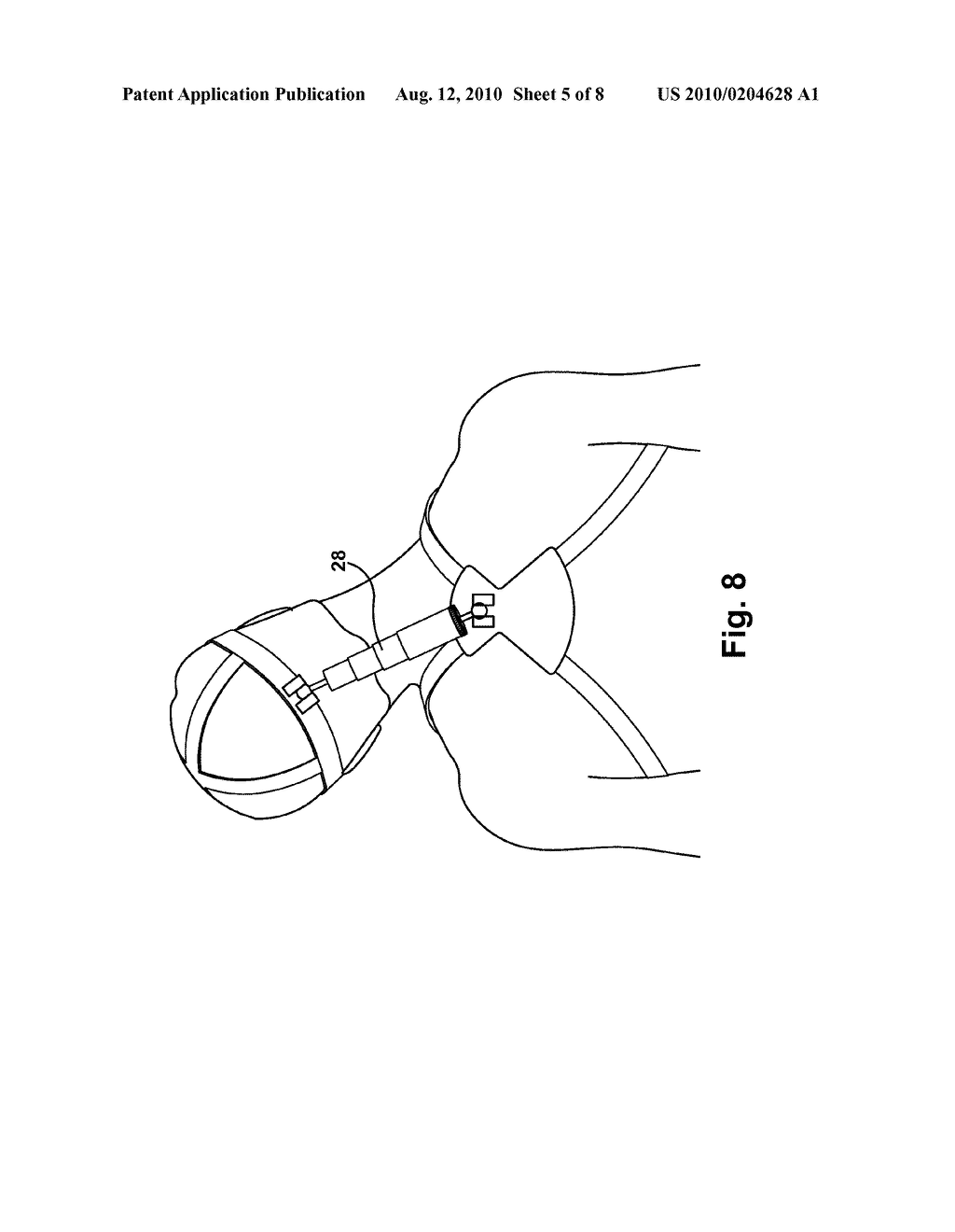 Apparatus and Methods for Reducing Brain and Cervical Spine Injury - diagram, schematic, and image 06