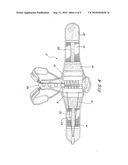 ADJUSTABLE EXTENSION COMPRESSION POSTERIOR SPINAL ORTHOSIS AND METHOD diagram and image