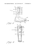 METHOD AND APPARATUS FOR THE TREATMENT OF PLANTAR ULCERS AND FOOT DEFORMITIES diagram and image