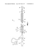 SYSTEM AND METHOD FOR TREATING ISCHEMIC STROKE diagram and image