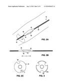 SYSTEM AND METHOD FOR TREATING ISCHEMIC STROKE diagram and image