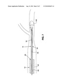 SYSTEM AND METHOD FOR TREATING ISCHEMIC STROKE diagram and image