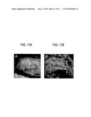 THERAPEUTIC HYBRID IMPLANTABLE DEVICES diagram and image